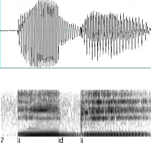 ungerundeter geschlossener Vorderzungenvokal