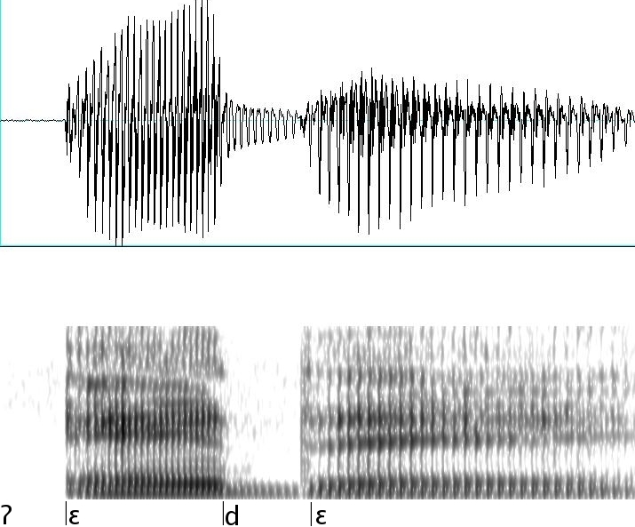 ungerundeter halboffener Vorderzungenvokal