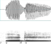 gerundeter geschlossener Vorderzungenvokal
