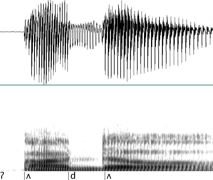 ungerundeter halboffener Hinterzungenvokal