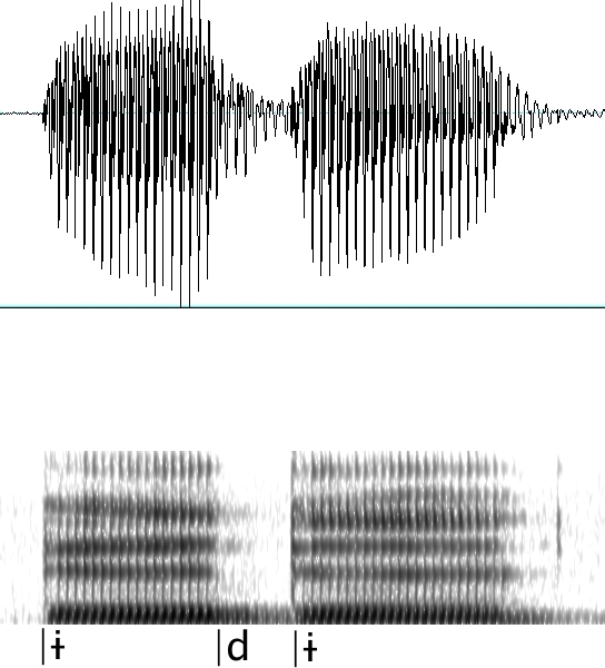 ungerundeter geschlossener Mittelzungenvokal